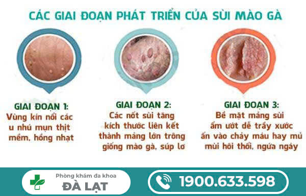 Hình ảnh minh họa